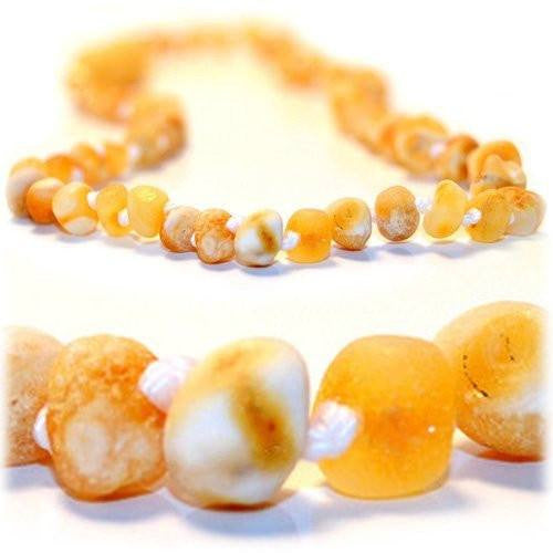 Baltic amber necklace of egg yolk and butterscotch beads.
